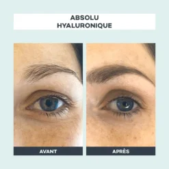 Absolu Hyaluronique - ANTI-GASPI 9 Absolu Hyaluronique - ANTI-GASPI -Endros Cosmetiques Boutique D LAB Avant Apres AbsoluHyaluronique