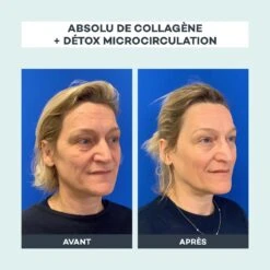 Détox Microcirculation -Endros Cosmetiques Boutique D LAB Avant Apres AbsoludeCollageneetDetoxMicrocirculation