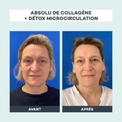 Absolu De Collagène -Endros Cosmetiques Boutique D LAB Avant Apres AbsoludeCollageneetDetoxMicrocirculation 2 43bf59f9 06bb 4164 aeb9 e39e0b29ace0