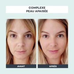 Devant -Endros Cosmetiques Boutique D LAB Avant Apres ComplexePeauApaisee