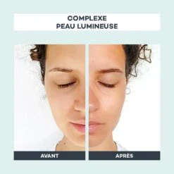 Devant -Endros Cosmetiques Boutique D LAB Avant Apres ComplexePeauLumineuse