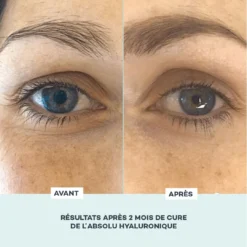 Absolu Hyaluronique -Endros Cosmetiques Boutique D LAB E shop RefontevisuelsFP AbsoluHyaluronique AvantApres 1 min