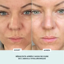 Absolu Hyaluronique -Endros Cosmetiques Boutique D LAB E shop RefontevisuelsFP AbsoluHyaluronique AvantApres 2 min