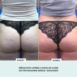 Brûle-Graisses -Endros Cosmetiques Boutique D LAB E shop RefontevisuelsFP Brule Graisses AvantApres min