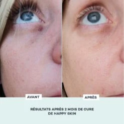 Happy Skin -Endros Cosmetiques Boutique D LAB E shop RefontevisuelsFP HappySkin AvantApres min