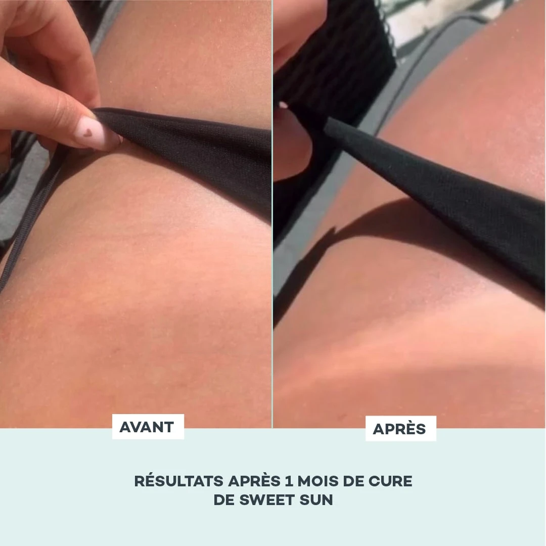 Sweet Sun 4 Sweet Sun – Image 4